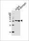 ADA Antibody (C-term)